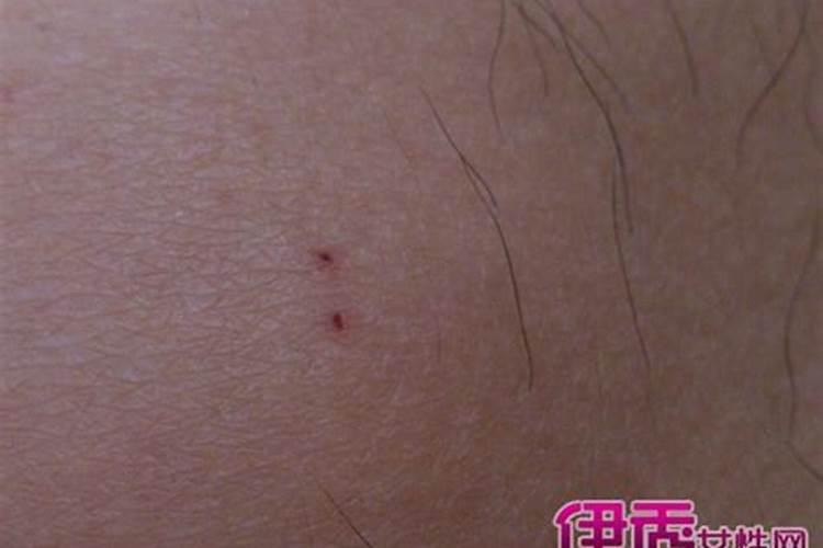 被老鼠咬了是什么预兆