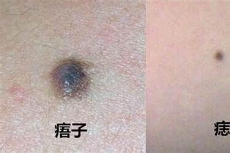 手上有痦子代表什么