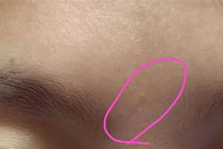 影响婚姻的痣长哪里 奸门位置长痣影响婚姻？