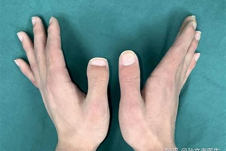 芦荟放在哪里风水好