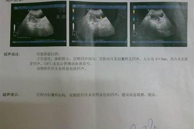 生活里邪门的事要注意哪些
