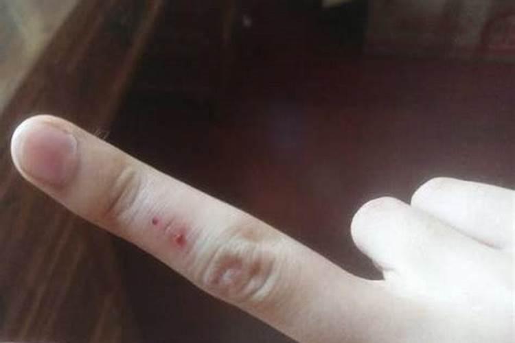 梦见手被割破了没流血怎么回事儿？